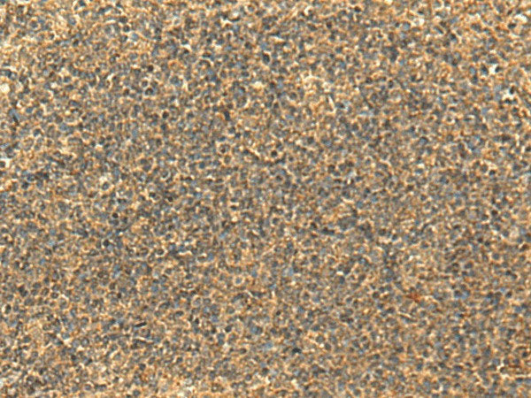 GLYATL2 Polyclonal Antibody Reactivity Human