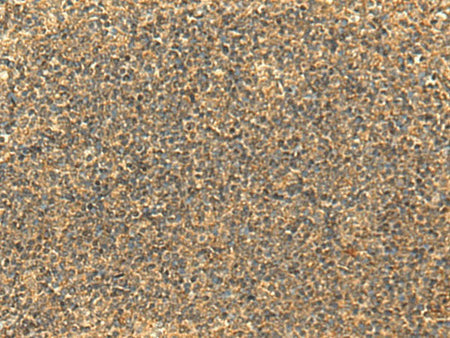 GLYATL2 Polyclonal Antibody Reactivity Human