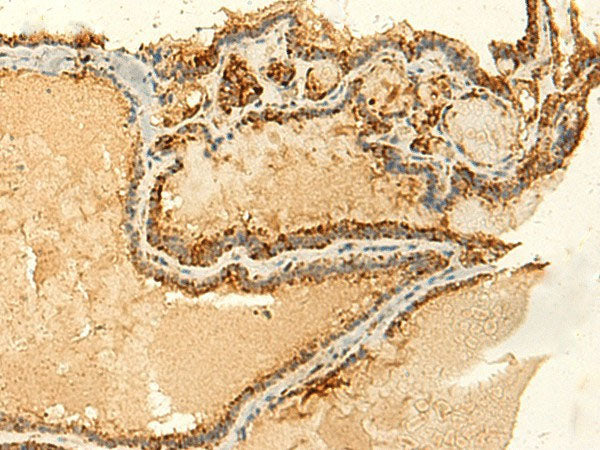 GLYATL2 Polyclonal Antibody Reactivity Human