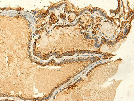 GLYATL2 Polyclonal Antibody Reactivity Human