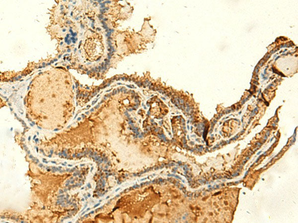 KIAA0513 Polyclonal Antibody Reactivity Human