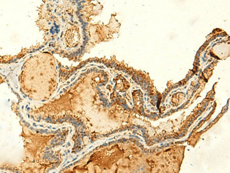 KIAA0513 Polyclonal Antibody Reactivity Human