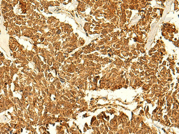 ABHD10 Polyclonal Antibody Reactivity Human