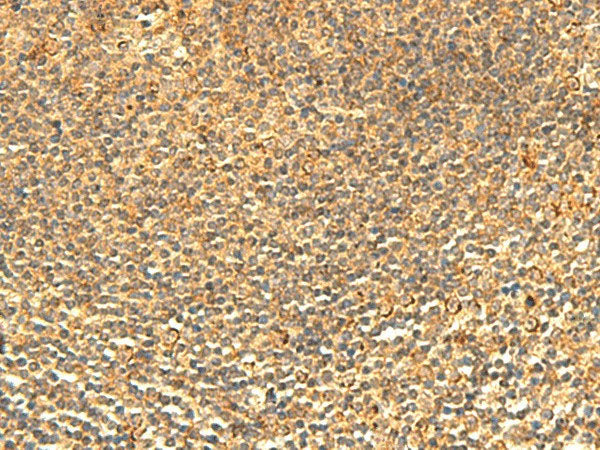 ABHD10 Polyclonal Antibody Reactivity Human