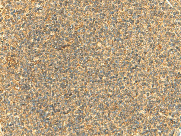 HMBOX1 Polyclonal Antibody Reactivity Human