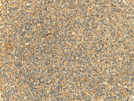 HMBOX1 Polyclonal Antibody Reactivity Human