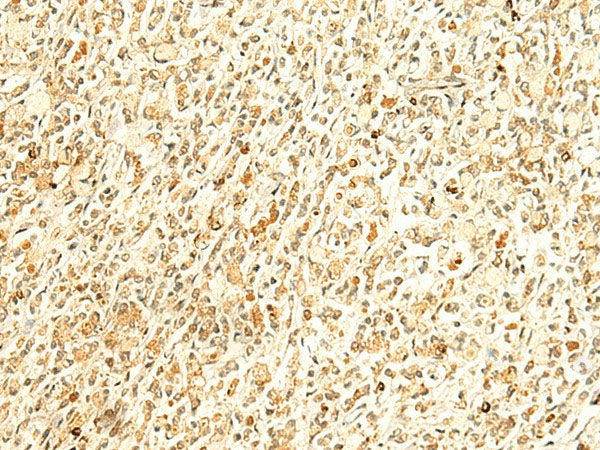 HMBOX1 Polyclonal Antibody Reactivity Human
