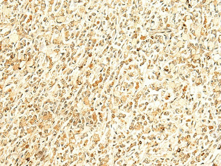 HMBOX1 Polyclonal Antibody Reactivity Human