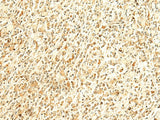 HMBOX1 Polyclonal Antibody Reactivity Human