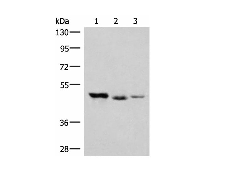 HMBOX1 Polyclonal Antibody Reactivity Human
