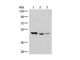 HMBOX1 Polyclonal Antibody Reactivity Human