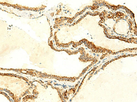 NAPRT Polyclonal Antibody Reactivity Human