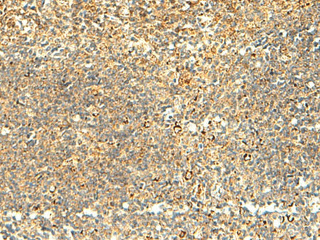 NAPRT Polyclonal Antibody Reactivity Human