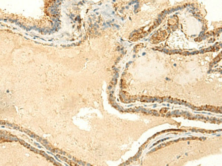 NTAN1 Polyclonal Antibody Reactivity Human
