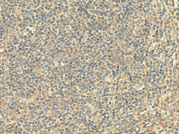 NTAN1 Polyclonal Antibody Reactivity Human