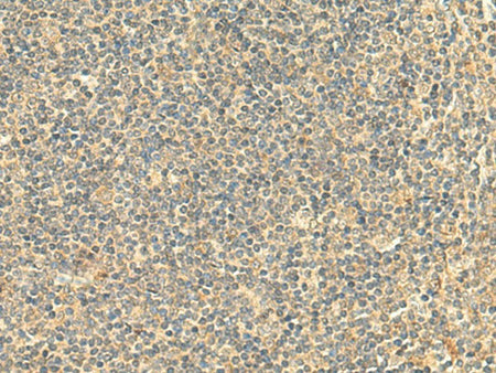NTAN1 Polyclonal Antibody Reactivity Human