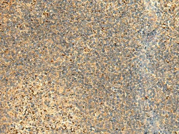 ATP5PD Polyclonal Antibody Reactivity Human