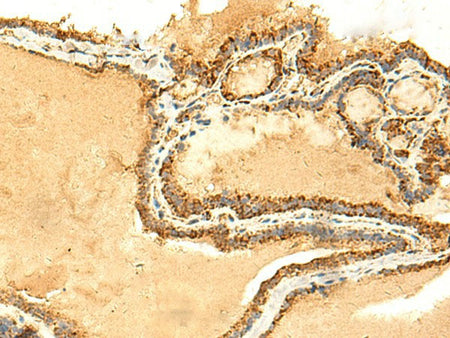 ATP5PD Polyclonal Antibody Reactivity Human