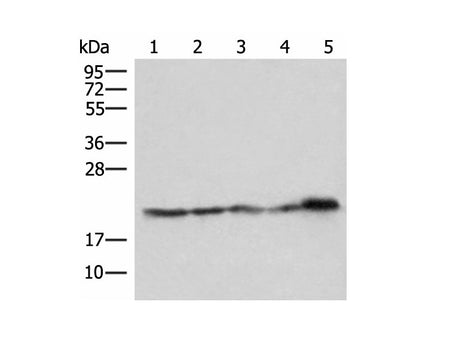 ATP5PD Polyclonal Antibody Reactivity Human