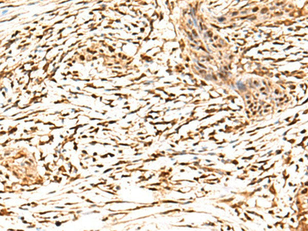 RETREG1 Polyclonal Antibody Reactivity Human