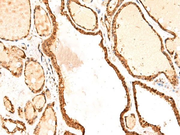 RETREG1 Polyclonal Antibody Reactivity Human