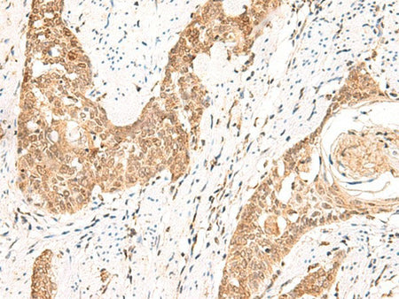 PPP1R3C Polyclonal Antibody Reactivity Human