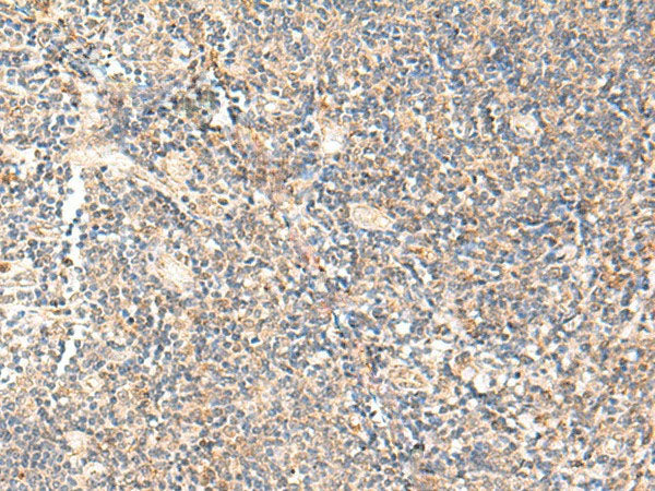 PPP1R3C Polyclonal Antibody Reactivity Human