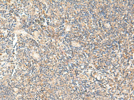 PPP1R3C Polyclonal Antibody Reactivity Human