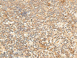 TRAPPC1 Polyclonal Antibody Reactivity Human