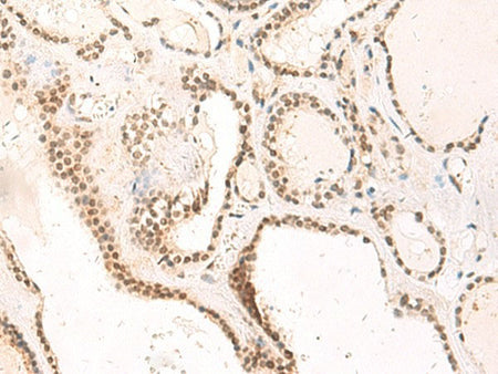 TEAD3 Polyclonal Antibody Reactivity Human