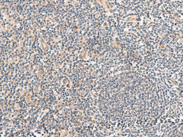 TEAD3 Polyclonal Antibody Reactivity Human