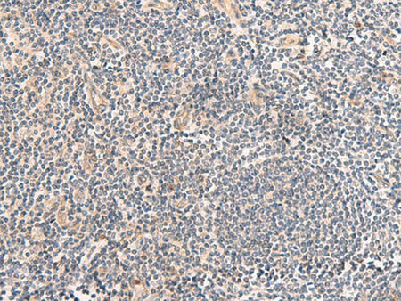 TEAD3 Polyclonal Antibody Reactivity Human