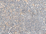 TEAD3 Polyclonal Antibody Reactivity Human