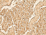 WDR33 Polyclonal Antibody Reactivity Human