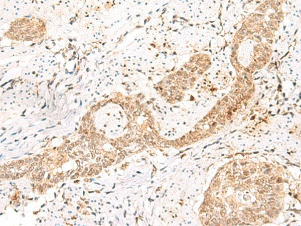 PRKAG2 Polyclonal Antibody