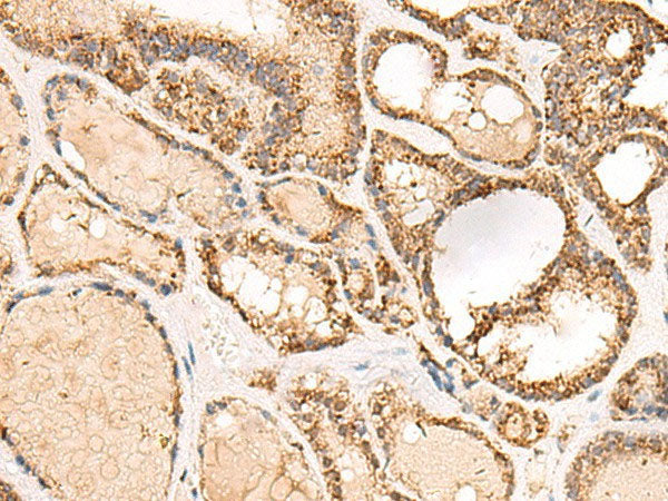 ECH1 Polyclonal Antibody Reactivity Human