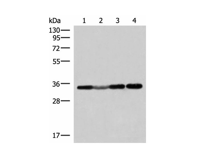 ECH1 Polyclonal Antibody Reactivity Human