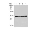ECH1 Polyclonal Antibody Reactivity Human