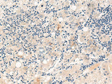 CYYR1 Polyclonal Antibody Reactivity Human