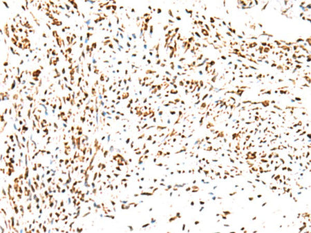 KCTD13 Polyclonal Antibody Reactivity Human