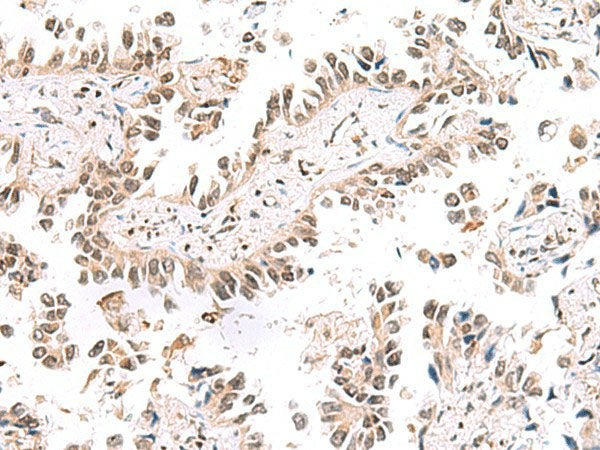 KCTD13 Polyclonal Antibody Reactivity Human