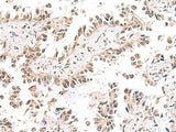 KCTD13 Polyclonal Antibody Reactivity Human