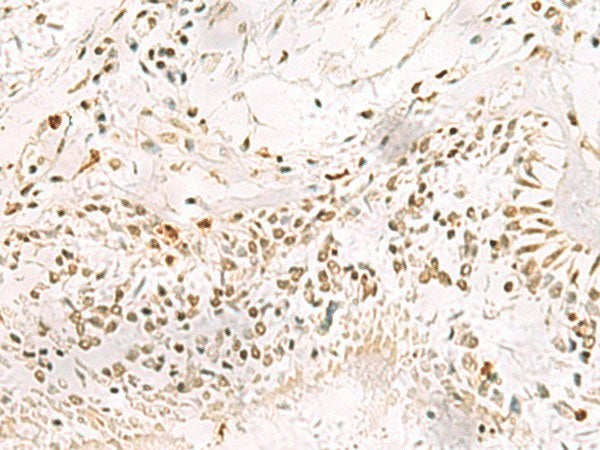 PDS5A Polyclonal Antibody