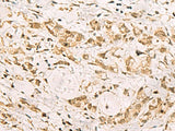 PDS5A Polyclonal Antibody