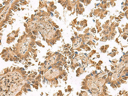 PTH1R Polyclonal Antibody Reactivity Human