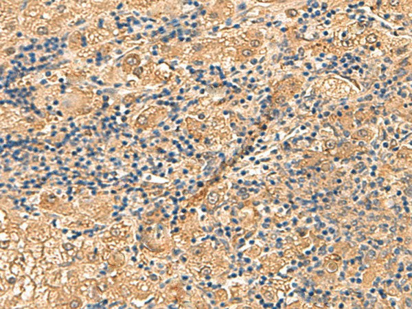 PTH1R Polyclonal Antibody Reactivity Human