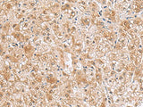 RTKN2 Polyclonal Antibody Reactivity Human
