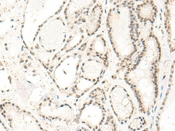 DUT Polyclonal Antibody Reactivity Human