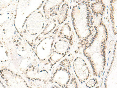 DUT Polyclonal Antibody Reactivity Human