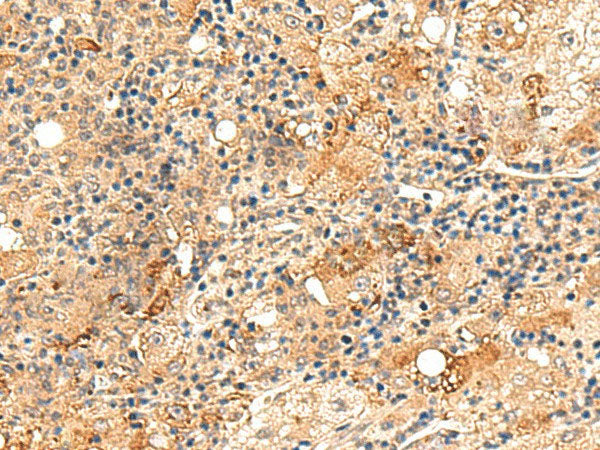 REG1B Polyclonal Antibody Reactivity Human